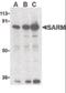 Sterile Alpha And TIR Motif Containing 1 antibody, orb86443, Biorbyt, Western Blot image 