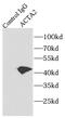 Actin Alpha 2, Smooth Muscle antibody, FNab08038, FineTest, Immunoprecipitation image 