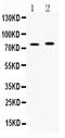 Long-chain-fatty-acid--CoA ligase 5 antibody, A05087-2, Boster Biological Technology, Western Blot image 