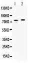 Acyl-CoA Synthetase Long Chain Family Member 5 antibody, A05087-2, Boster Biological Technology, Western Blot image 