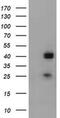 Alpha-1,4-N-Acetylglucosaminyltransferase antibody, MA5-26433, Invitrogen Antibodies, Western Blot image 