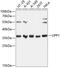 Uridine Phosphorylase 1 antibody, GTX66155, GeneTex, Western Blot image 