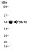 Translocase Of Outer Mitochondrial Membrane 70 antibody, TA336526, Origene, Western Blot image 