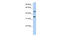 Phosphoinositide-binding protein PIP3-E antibody, 26-112, ProSci, Enzyme Linked Immunosorbent Assay image 