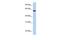 Adhesion Molecule With Ig Like Domain 3 antibody, GTX45156, GeneTex, Western Blot image 