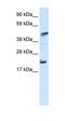 IKAROS Family Zinc Finger 5 antibody, orb324468, Biorbyt, Western Blot image 