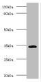 CD74 antibody, A55559-100, Epigentek, Western Blot image 
