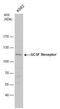 Colony Stimulating Factor 3 Receptor antibody, PA5-28988, Invitrogen Antibodies, Western Blot image 