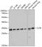 Clathrin Light Chain B antibody, GTX64881, GeneTex, Western Blot image 