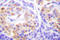 Collagen Type III Alpha 1 Chain antibody, LS-C176407, Lifespan Biosciences, Immunohistochemistry paraffin image 