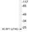 Eukaryotic Translation Initiation Factor 4E Binding Protein 1 antibody, LS-C178023, Lifespan Biosciences, Western Blot image 