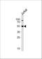 AKT Serine/Threonine Kinase 3 antibody, A00520-1, Boster Biological Technology, Western Blot image 