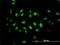 Tousled Like Kinase 2 antibody, H00011011-M01, Novus Biologicals, Immunofluorescence image 