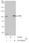 Epidermal Growth Factor Receptor Pathway Substrate 8 antibody, GTX100254, GeneTex, Immunoprecipitation image 