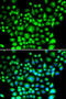 B Cell Receptor Associated Protein 31 antibody, STJ29136, St John