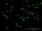 Zinc Finger CCHC-Type Containing 9 antibody, H00084240-B01P, Novus Biologicals, Immunofluorescence image 