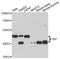 TATA-Box Binding Protein antibody, STJ112223, St John