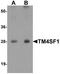 Transmembrane 4 L6 family member 1 antibody, NBP1-76549, Novus Biologicals, Western Blot image 