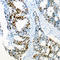 Cyclin Dependent Kinase 2 antibody, LS-C353949, Lifespan Biosciences, Immunohistochemistry frozen image 