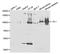 Villin 1 antibody, STJ27447, St John