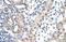 Small Nuclear Ribonucleoprotein D1 Polypeptide antibody, A08352, Boster Biological Technology, Immunohistochemistry paraffin image 