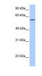 Acyl-CoA Synthetase Bubblegum Family Member 2 antibody, NBP1-54963, Novus Biologicals, Western Blot image 