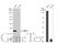 Transmembrane Protein 173 antibody, GTX134373, GeneTex, Western Blot image 