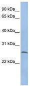 Chymotrypsin Like Elastase 1 antibody, TA340038, Origene, Western Blot image 