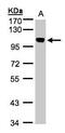 Non-SMC Condensin I Complex Subunit H antibody, GTX107344, GeneTex, Western Blot image 