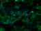 Transforming Acidic Coiled-Coil Containing Protein 3 antibody, GTX83534, GeneTex, Immunocytochemistry image 