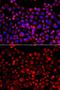Sulfotransferase Family 1E Member 1 antibody, GTX65828, GeneTex, Immunofluorescence image 