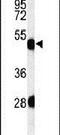 Keratin 82 antibody, PA5-24971, Invitrogen Antibodies, Western Blot image 