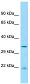 Ciliary Associated Calcium Binding Coiled-Coil 1 antibody, TA330962, Origene, Western Blot image 