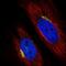 Beta-1,4-Galactosyltransferase 1 antibody, PA5-52743, Invitrogen Antibodies, Immunofluorescence image 