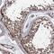 Protein CIP2A antibody, HPA039570, Atlas Antibodies, Immunohistochemistry frozen image 