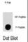 Mitogen-Activated Protein Kinase Kinase Kinase Kinase 4 antibody, abx031987, Abbexa, Western Blot image 