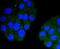 Troponin I3, Cardiac Type antibody, A01720-2, Boster Biological Technology, Immunocytochemistry image 