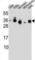 SSX Family Member 4B antibody, abx027280, Abbexa, Western Blot image 