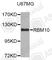 RNA Binding Motif Protein 10 antibody, A4209, ABclonal Technology, Western Blot image 