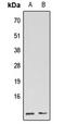 G Protein Subunit Gamma 5 antibody, LS-C358988, Lifespan Biosciences, Western Blot image 