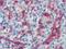 Major Histocompatibility Complex, Class I, G antibody, NB110-55297, Novus Biologicals, Immunohistochemistry paraffin image 