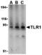 Toll Like Receptor 1 antibody, A00429, Boster Biological Technology, Western Blot image 