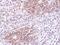 Autophagy Related 4D Cysteine Peptidase antibody, PA5-28363, Invitrogen Antibodies, Immunohistochemistry paraffin image 