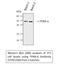 Peroxisome Proliferator Activated Receptor Alpha antibody, STJ95200, St John