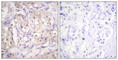 B-Raf Proto-Oncogene, Serine/Threonine Kinase antibody, abx012468, Abbexa, Western Blot image 
