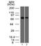 Endoglin antibody, 33-704, ProSci, Western Blot image 