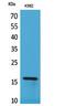 Retinol Binding Protein 2 antibody, STJ96752, St John