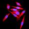 Kinesin Light Chain 1 antibody, A04116-2, Boster Biological Technology, Immunofluorescence image 