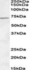 Acyl-CoA Dehydrogenase Very Long Chain antibody, orb107642, Biorbyt, Western Blot image 