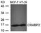 Cellular Retinoic Acid Binding Protein 2 antibody, orb43484, Biorbyt, Western Blot image 